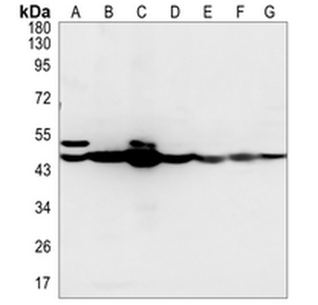 Cytokeratin 18 Rabbit Monoclonal Antibody
