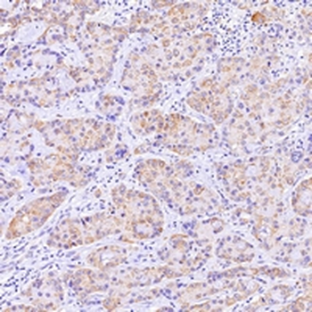 Cytokeratin 18 Rabbit Monoclonal Antibody