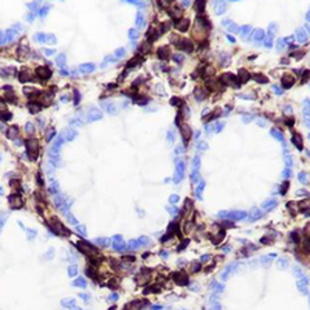 CD45 Rabbit Monoclonal Antibody