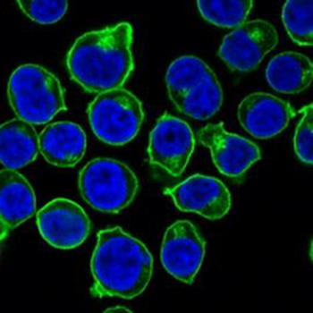 CD45 Rabbit Monoclonal Antibody