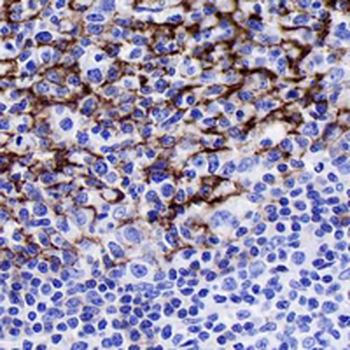 CD23 Rabbit Monoclonal Antibody