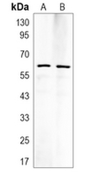 TAU (Phospho-T498/T181) Rabbit Monoclonal Antibody