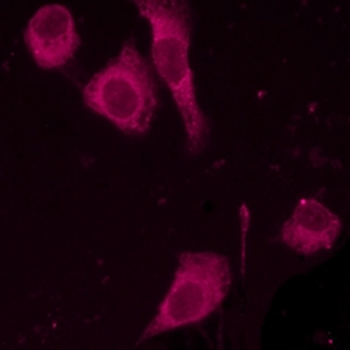 Goat Anti-Rabbit IgG (H&L) Antibody (AcalephFluor647)