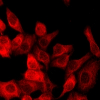 Goat Anti-Rabbit IgG (H&L) Antibody (AcalephFluor594)