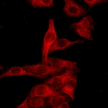 Goat Anti-Mouse IgG (H&L) Antibody (AcalephFluor594)