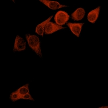 Goat Anti-Mouse IgG (H&L) Antibody (AcalephFluor555)