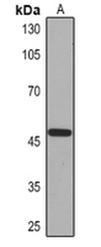 Cytokeratin 18 Mouse Monoclonal Antibody