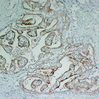 Cytokeratin 18 Mouse Monoclonal Antibody