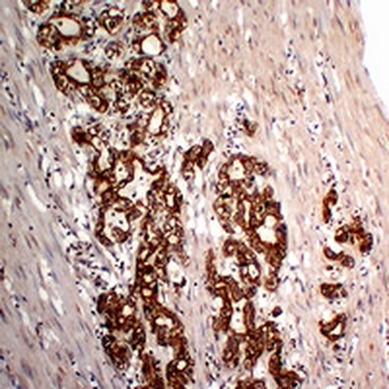 Cytokeratin 18 Mouse Monoclonal Antibody