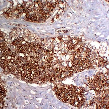 Cytokeratin 18 Mouse Monoclonal Antibody