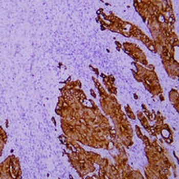 Cytokeratin 18 Mouse Monoclonal Antibody