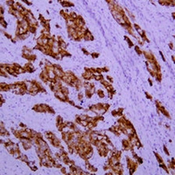 Cytokeratin 18 Mouse Monoclonal Antibody