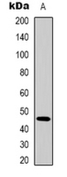 Cytokeratin 18 Rabbit Polyclonal Antibody