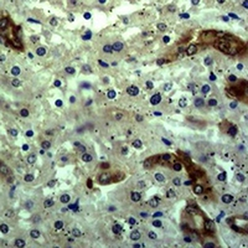 Cytokeratin 18 Rabbit Polyclonal Antibody