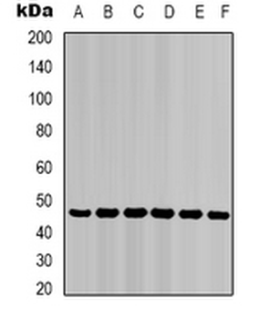 Cytokeratin 18 Mouse Monoclonal Antibody