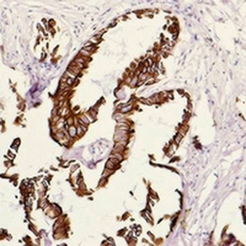 Cytokeratin 18 Mouse Monoclonal Antibody