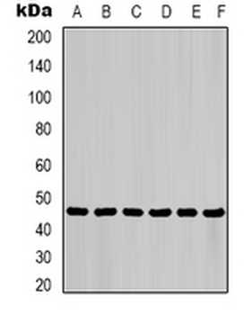 Cytokeratin 18 Mouse Monoclonal Antibody