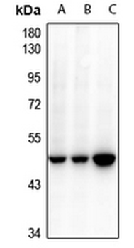 Cytokeratin 18 Rabbit Polyclonal Antibody