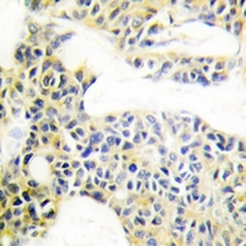Cytokeratin 18 Rabbit Polyclonal Antibody