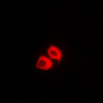 Cytokeratin 18 Rabbit Polyclonal Antibody