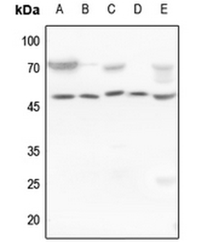 Cytokeratin 18 Rabbit Polyclonal Antibody
