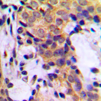 Cytokeratin 18 Rabbit Polyclonal Antibody