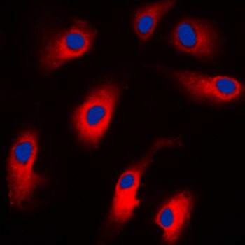 Cytokeratin 18 Rabbit Polyclonal Antibody