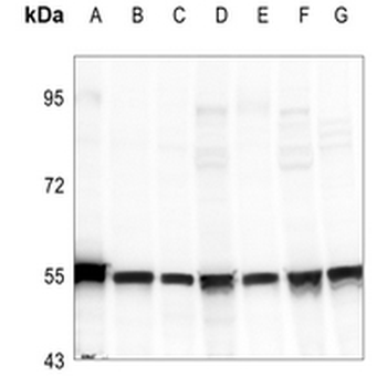 Cytokeratin 18 (Phospho-S33) Rabbit Polyclonal Antibody