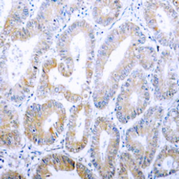Cytokeratin 18 (Phospho-S33) Rabbit Polyclonal Antibody