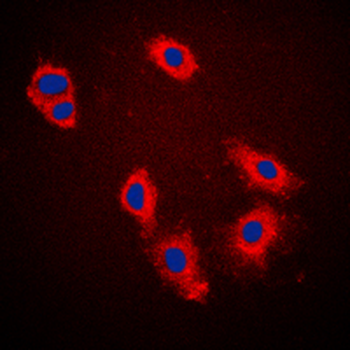Cytokeratin 18 (Phospho-S33) Rabbit Polyclonal Antibody