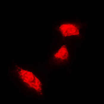 Cytokeratin 18 Rabbit Polyclonal Antibody