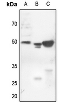 Cytokeratin 18 (Phospho-S52) Rabbit Polyclonal Antibody