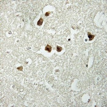 Cytokeratin 18 (Phospho-S52) Rabbit Polyclonal Antibody