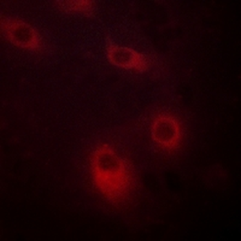 Cytokeratin 18 (Phospho-S52) Rabbit Polyclonal Antibody