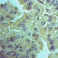 Anti-PNPLA6 Antibody