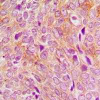 Anti-DNA Polymerase gamma 2 Antibody