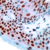 Anti-POM121 Antibody