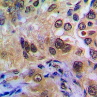 Anti-POTEA Antibody