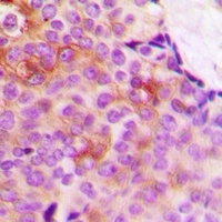 DARPP32 (Phospho-T75) Antibody
