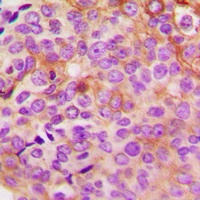 PKA C gamma Antibody