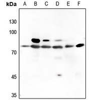 PKC beta Antibody
