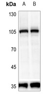 PRKD2 (Phospho-S876) Antibody