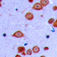 PRKD2 (Phospho-S876) Antibody