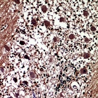 Anti-Prolactin Antibody