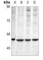 Protein C Rabbit Polyclonal Antibody