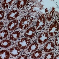 Protein C Rabbit Polyclonal Antibody