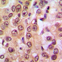PTEN (Phospho-S370) Antibody