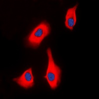 Anti-PTHR1 Antibody