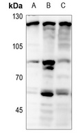 Focal Adhesion Kinase (Phospho-Y397) Antibody