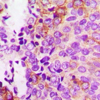 Focal Adhesion Kinase (Phospho-Y397) Antibody